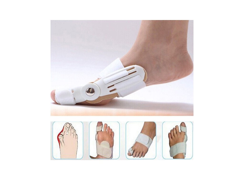 orteza degetelor de la picioare - corector pentru deget deformat